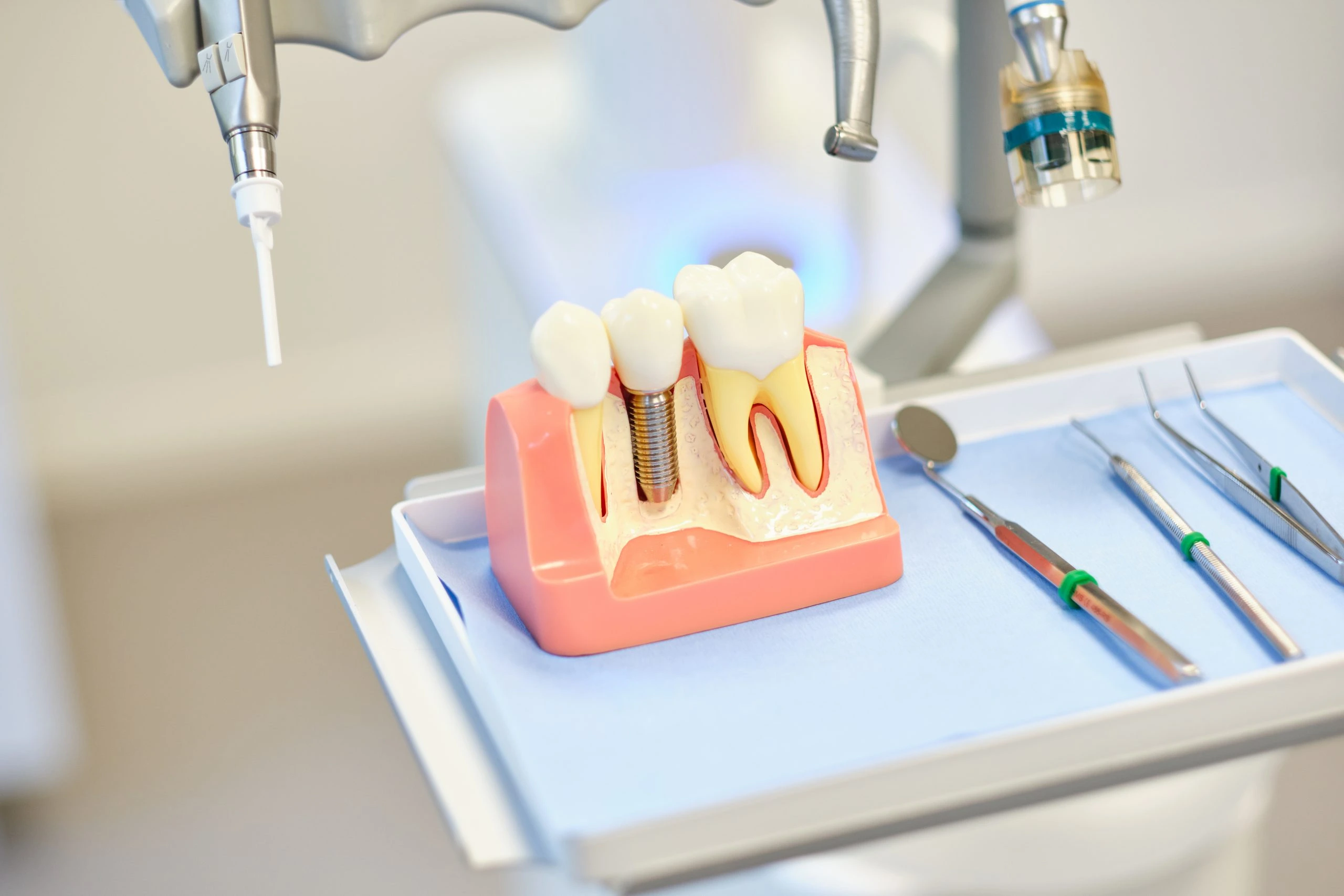 Implantaten plaatsen