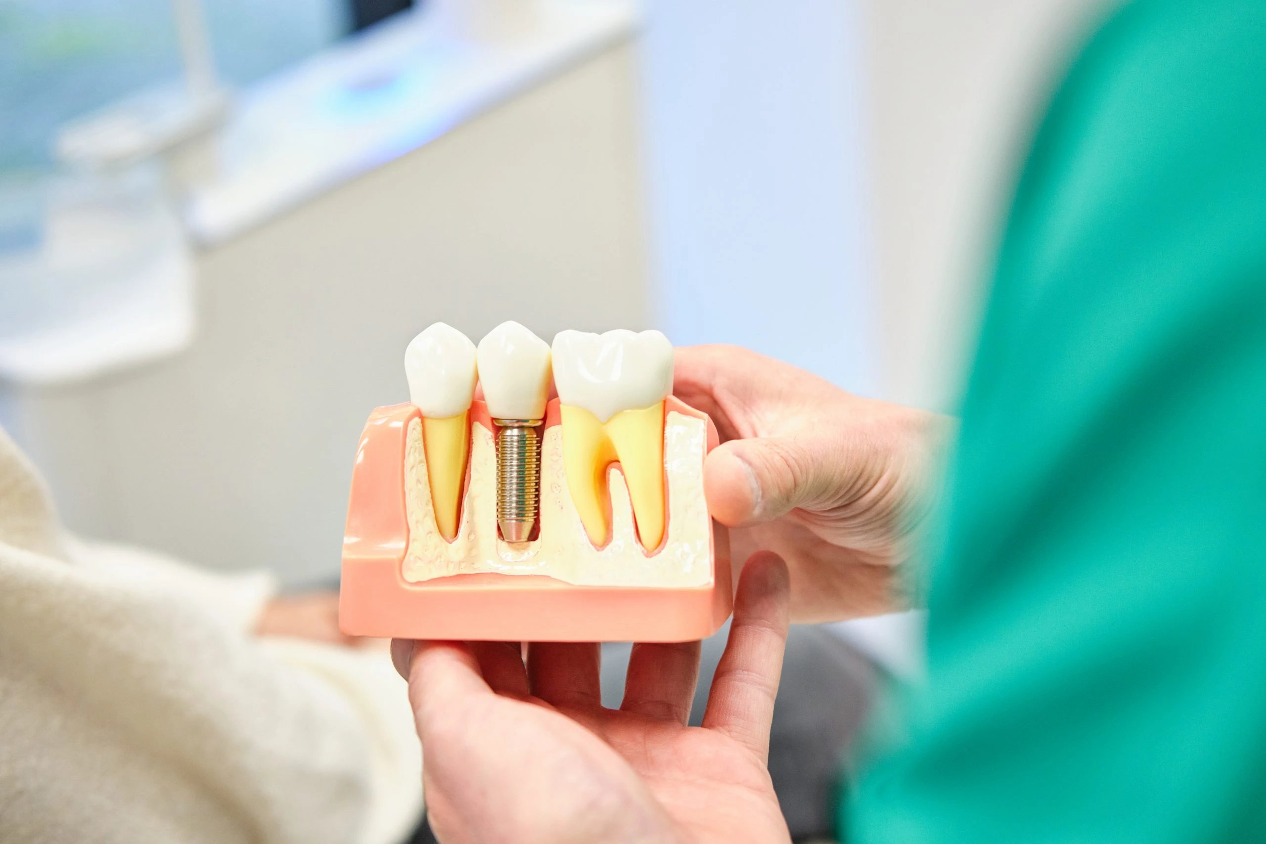 Tandarts Bakx kosten implantaten