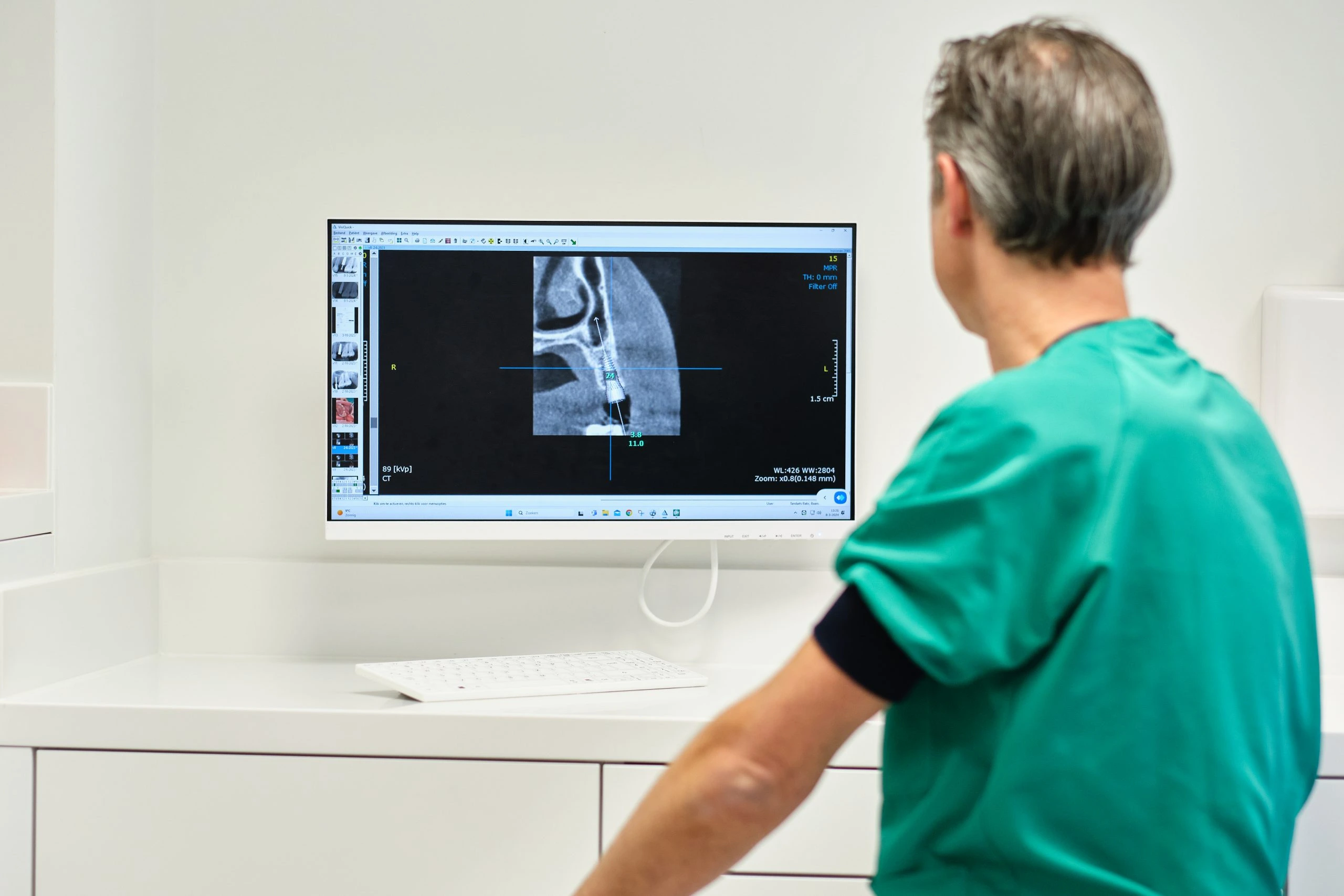 Bakx tandarts metaalvrije implantaten